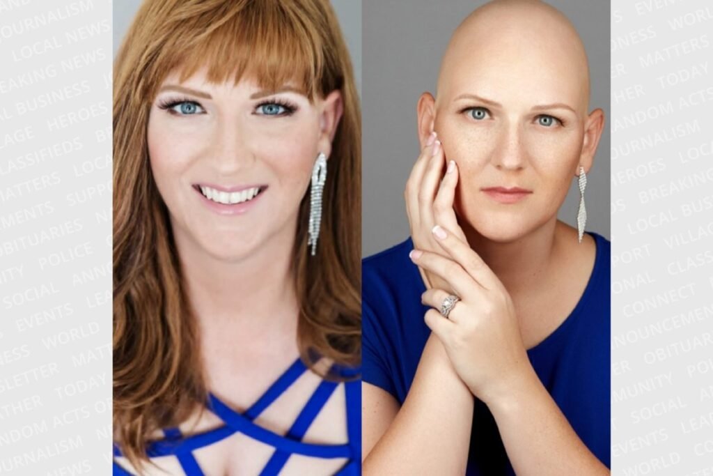Wearing A Wig Creates A 'whole New Adventure' For Alopecia