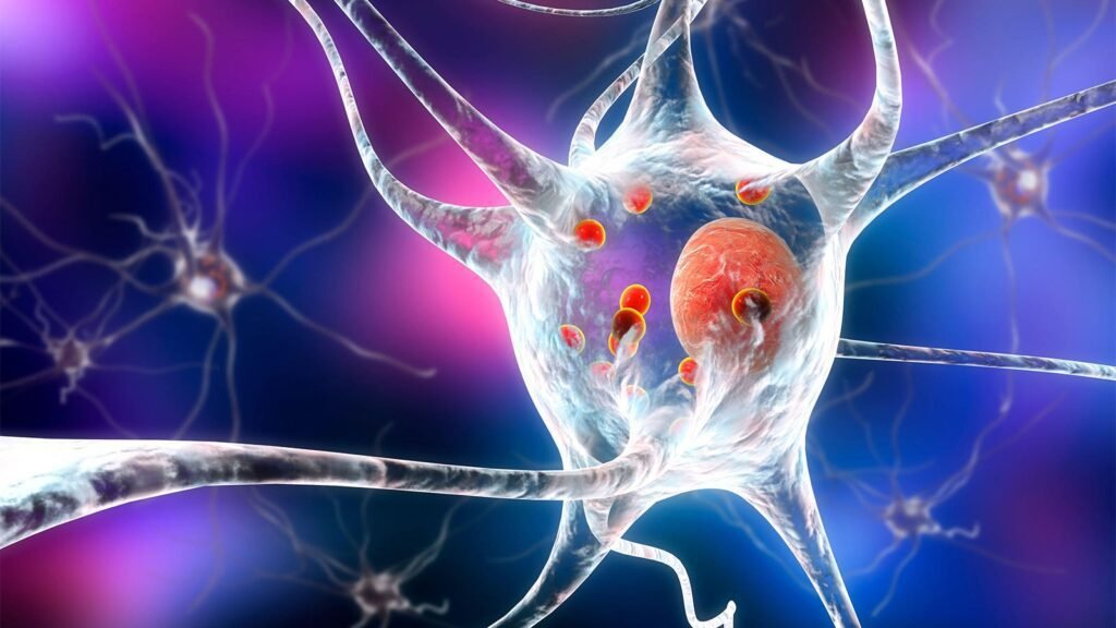Researchers Propose New Definition Of Parkinson's Disease Based On Biomarkers